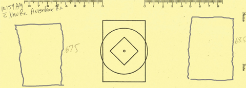 Fig. 5. J.F.’s second tracing showed significantly less difference in size.