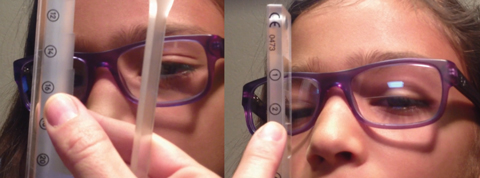 Fig. 6. Constant alternating esotropia improves to 4 esophoria through +1.50 add.