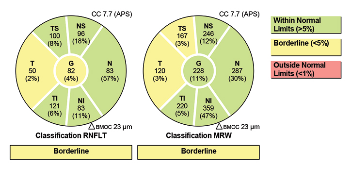 Fig. 5. The Garway-Heath sectors from the Hood report, as determined by the Spectralis. 