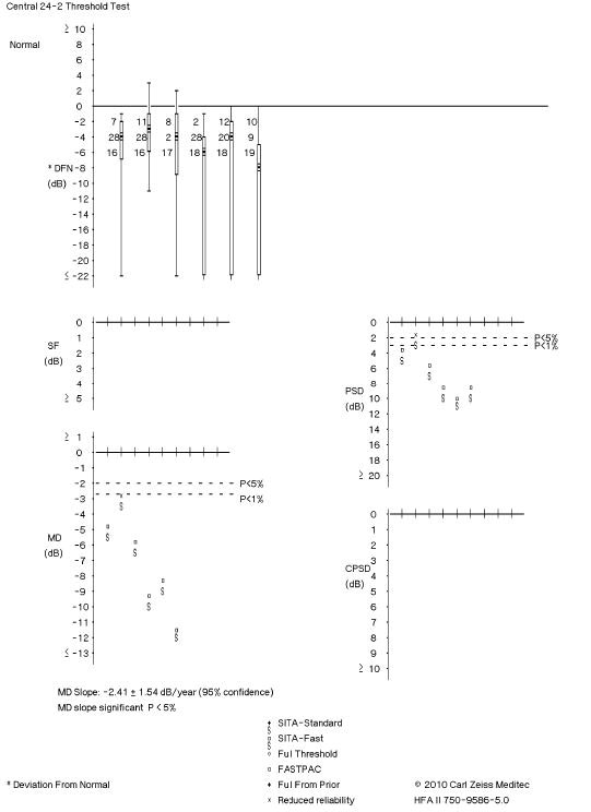 Fig. 2. This visual field readout shows trend-based change, which indicates visual field progression.