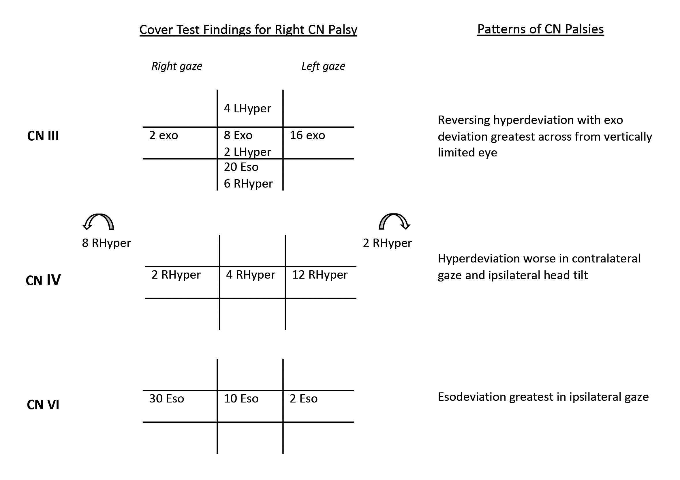 Patterns of right CN palsies (CN III, CN IV and CN VI) on cover test.