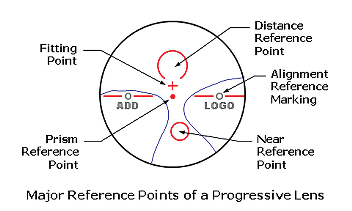 Fig. 2. The fitting cross is an important marker that designates the point of the lens that should be placed along the center of the patient’s pupil.