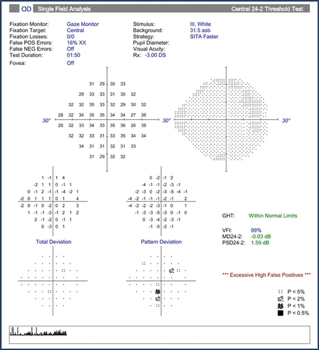 Fig. 21. Visual field of the same eye as Fig. 20  is clear and relatively reliable, and the GHT is within normal limits.