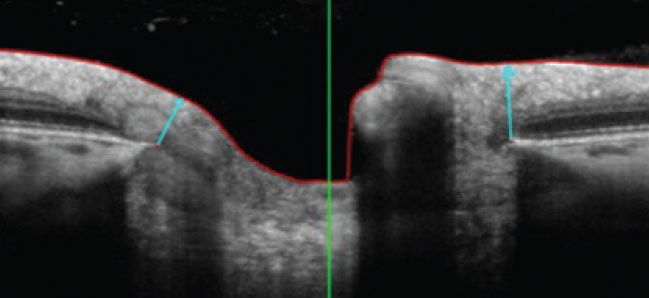 Arrows illustrate the MRW assessment.