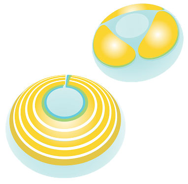 The MediPrint printing process can print multiple layers surrounding the optical zone. The layers may contain the same or different drugs; each layer may have diverse release kinetics.