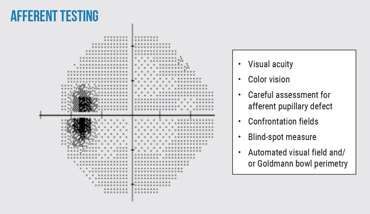 Fig. 2. Pertinent afferent tests to perform in patients with suspected or confirmed papilledema. Consider these tests during both baseline and follow-up examinations for comprehensive monitoring. Note the enlarged blind spot on automated 24-2 visual field seen in the left eye of a patient.