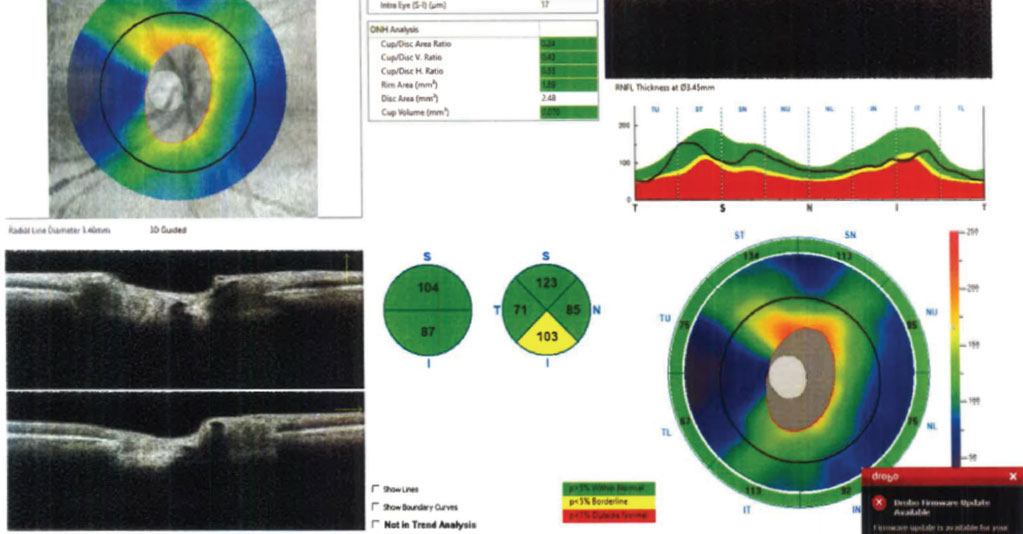 OCT came out on top in terms of long-term image reproducibility.