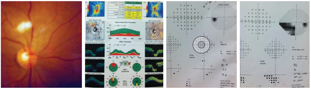 Examination and diagnostic findings in our patient. How to these correspond to her history and chief complaint?