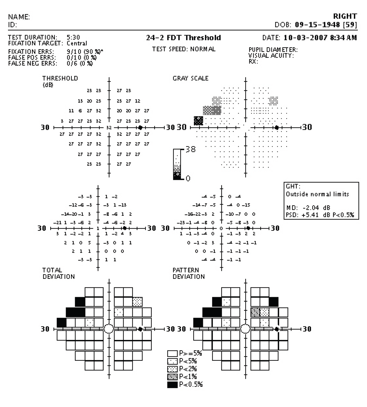 This study found that a greater difference in frequency-doubling technology perimetry and standard automated perimetry was associated with structural parameters. 