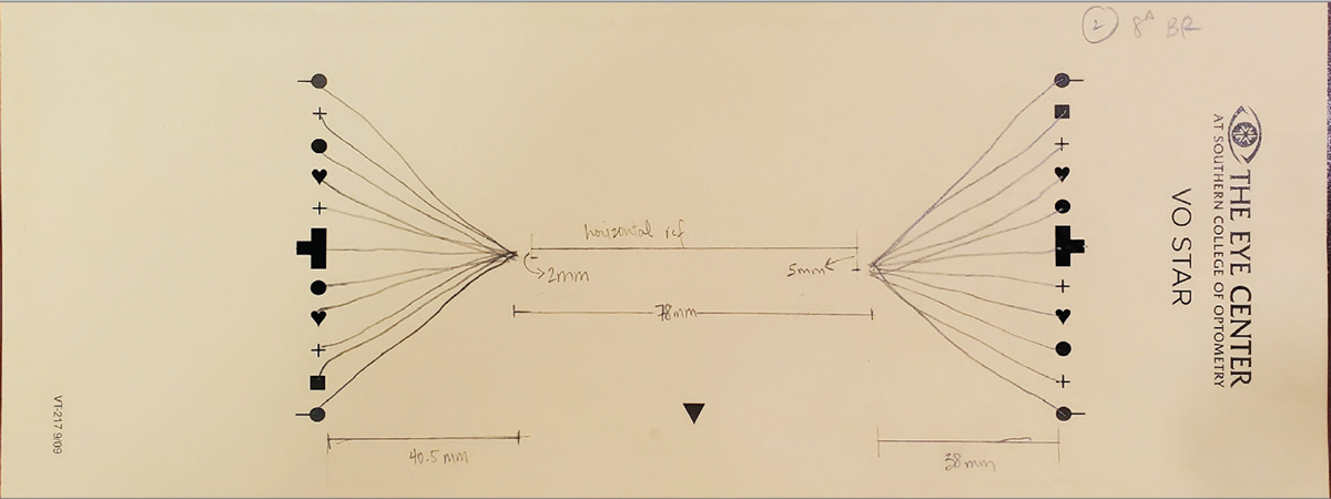 Fig 2. Van Orden star with 8^ base-right showing exacerbation of vertical misalignment. 